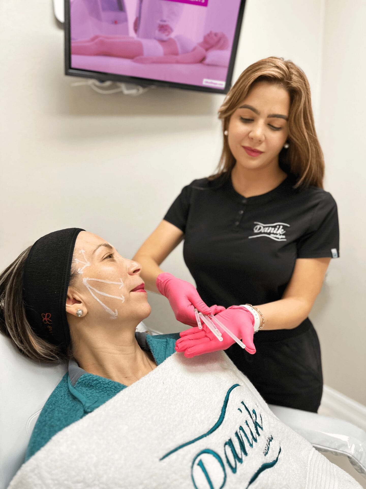 Specialist Applying PDO Threads Treatment For Skin Tightening On Woman Patient With Markings On Her Face To Outline The Treatment