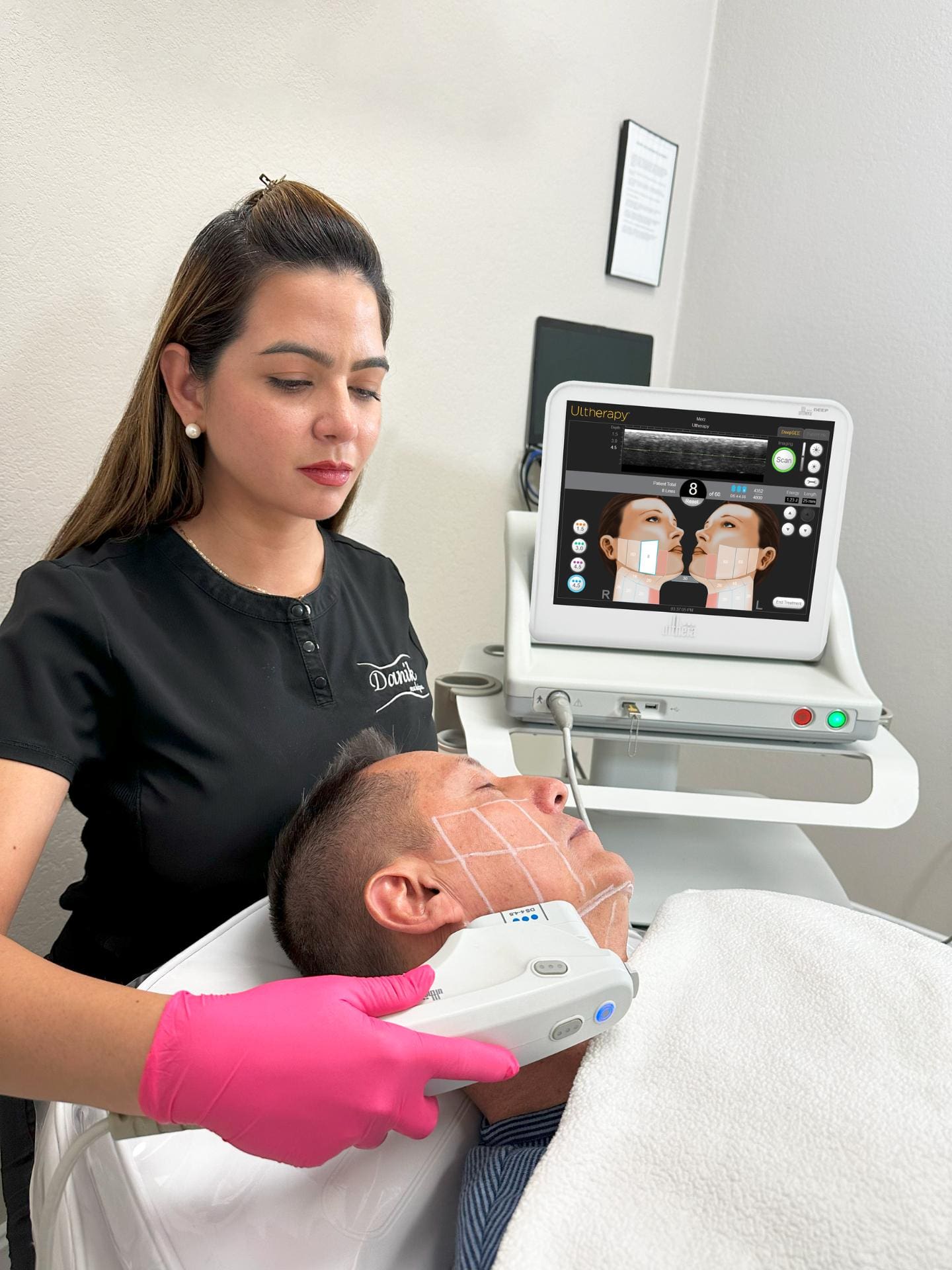 Specialist Wearing Black Uniform And Pink Gloves Applies Ultherapy Treatment To A Man Face With Lines For The Treatment Marked On His Face