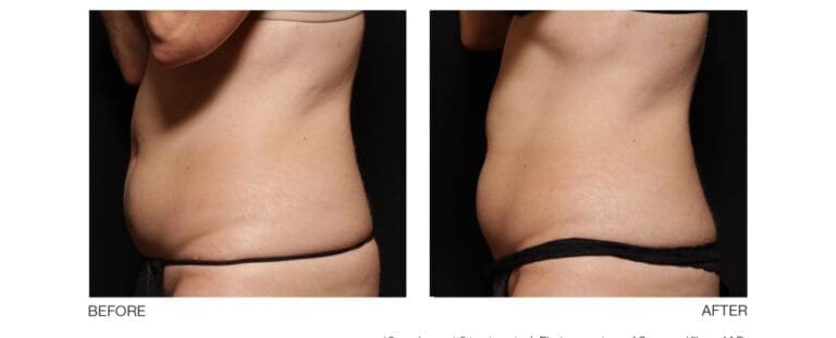 Body Contour