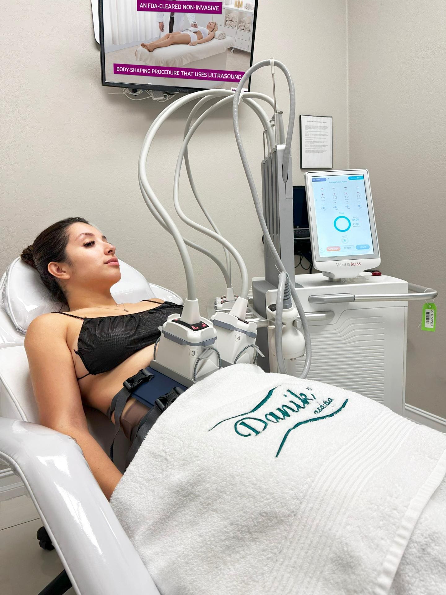 Woman Patient Receiving Venus Bliss Treatment For Body Contouring Focused On Her Abs While Laying Down