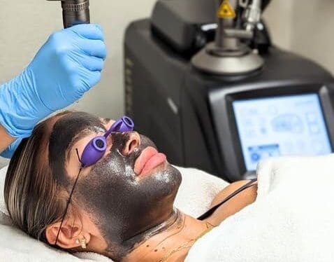 Specialist applying Carbon Laser Peel on a client at Danik MedSpa.